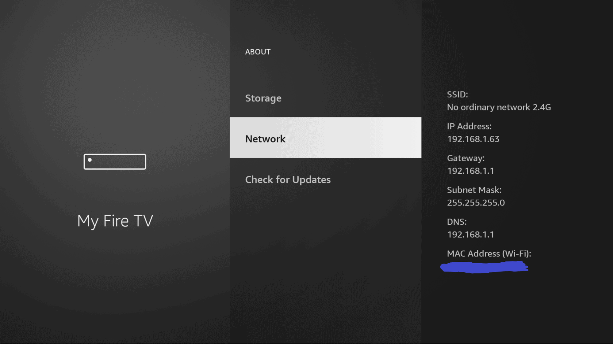 Network settings on a Fire TV device